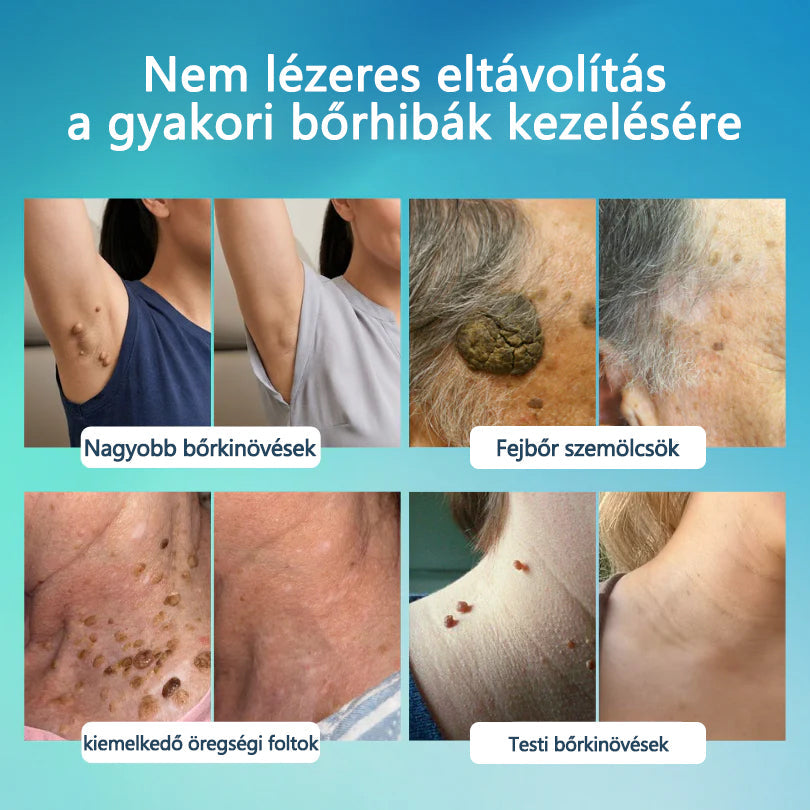 🌿Elara® SpotlessPro Fejlett Bőrápoló Toll