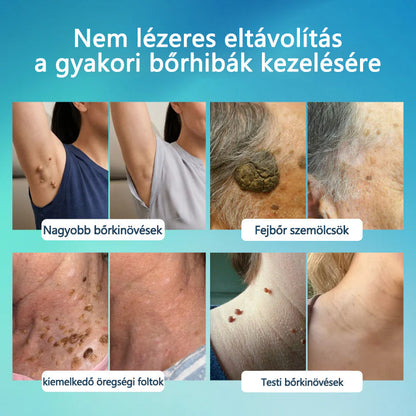 🌿Elara® SpotlessPro Fejlett Bőrápoló Toll