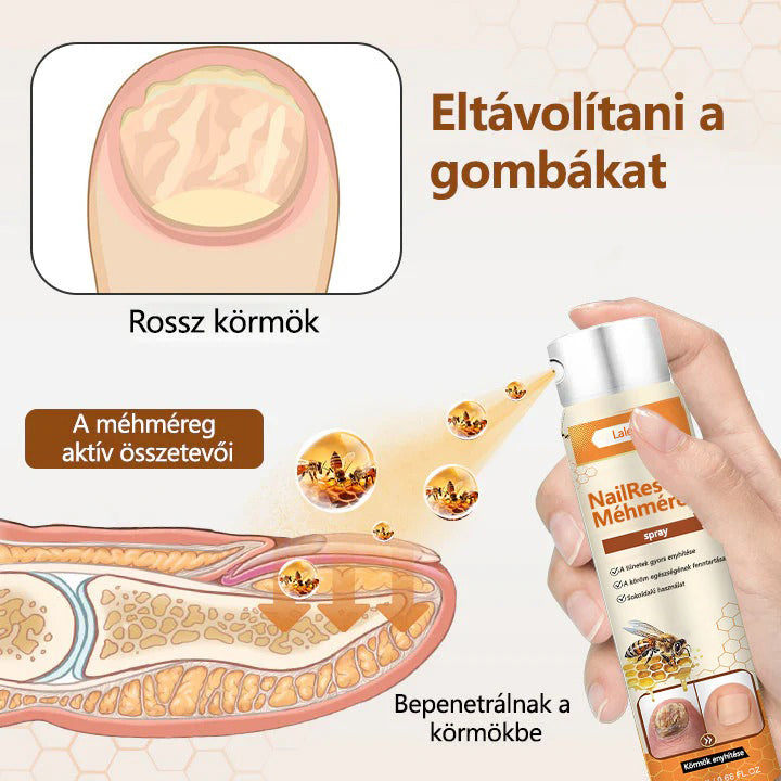 🌿Elara® NailRescue méhméreg spray
