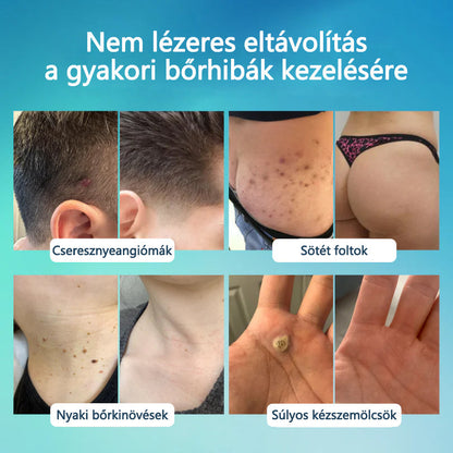 🌿Elara® SpotlessPro Fejlett Bőrápoló Toll