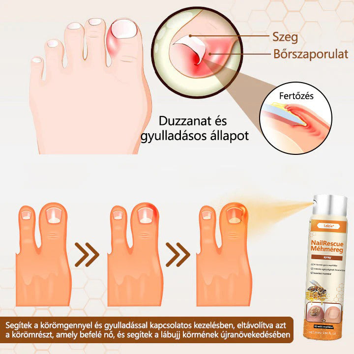 🌿Elara® NailRescue méhméreg spray