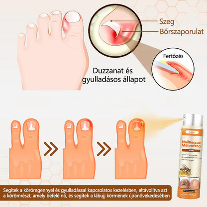 🌿Elara® NailRescue méhméreg spray