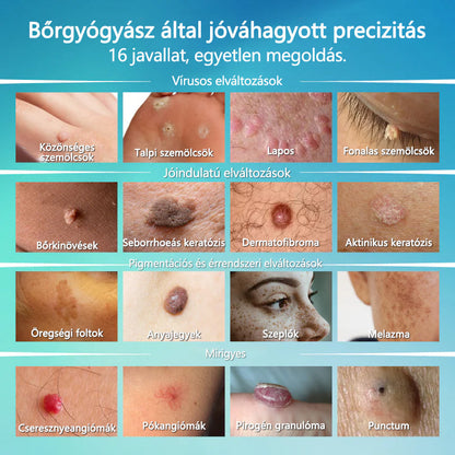 🌿Elara® SpotlessPro Fejlett Bőrápoló Toll
