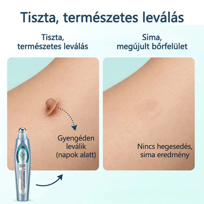 🌿Elara® SpotlessPro Fejlett Bőrápoló Toll